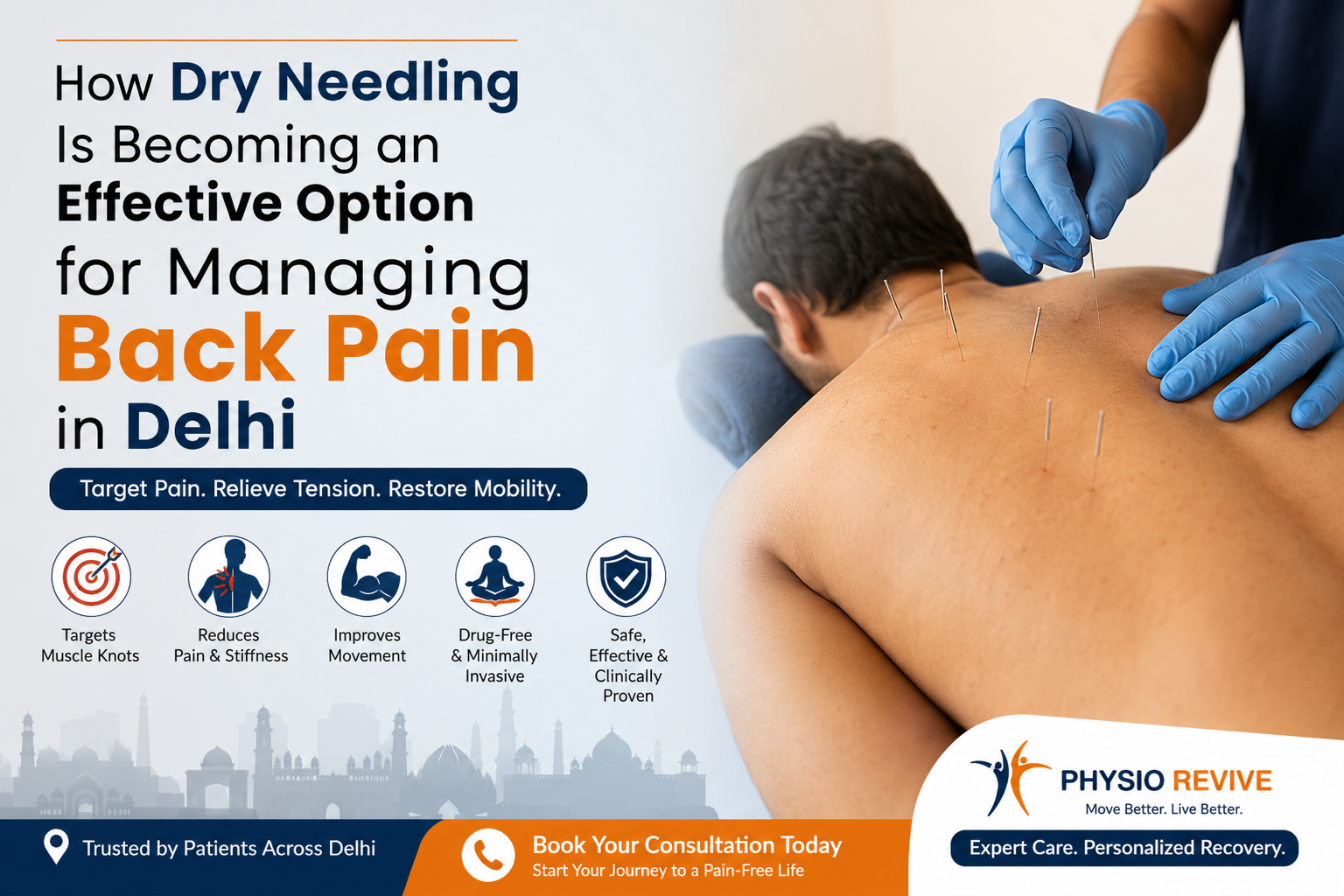 How-Dry-Needling-Is-Becoming-an-Effective-Option-for-Managing-Back-Pain-in-Delhi.png